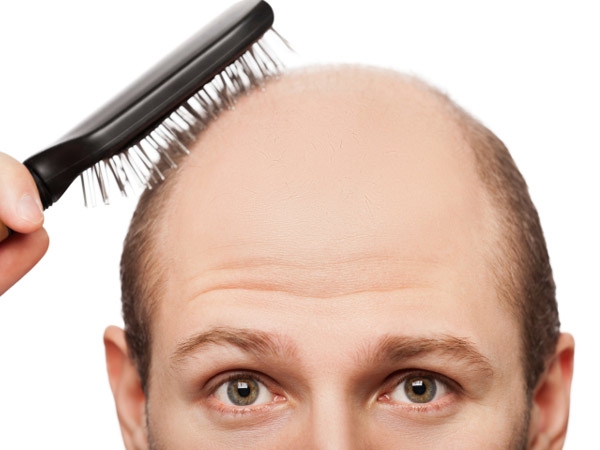 Image result for Latest Methods of Preventing Hair Loss